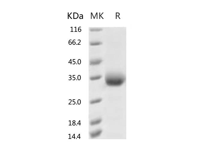 Recombinant 2019-nCoV Spike Protein (RBD, His Tag)(V483A)