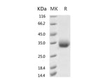 Recombinant 2019-nCoV Spike Protein (RBD, His Tag)(V483A)