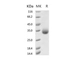 Recombinant 2019-nCoV Spike Protein (RBD, His Tag)(N354D)