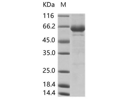 Recombinant Cox A16 (strain G-10) VP1 Protein (Fc Tag)