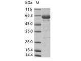 Recombinant Cox A16 (strain G-10) VP1 Protein (Fc Tag)