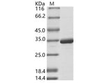 Recombinant DENV-2 (strain New Guinea C) NS5 (methyltransferase domain) / Nonstructural protein 5 Protein (His Tag)