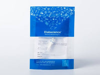 Recombinant EBOV (Subtype Sudan, strain Gulu) Glycoprotein / GP1 (mucin domain deleted) Protein (His Tag)