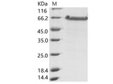 Recombinant EBOV (Sudan ebolavirus, strain Gulu) Nucleoprotein / NP (aa361-aa738) Protein (His Tag)