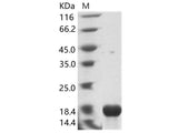 Recombinant EBOV (Sudan ebolavirus, strain Gulu) Nucleoprotein / NP Protein (His Tag)