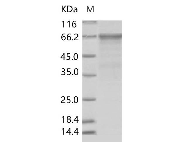 Recombinant Enterovirus D68 (EV-D68) (strain Fermon) VP1 Protein (Fc Tag)