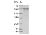 Recombinant Enterovirus D68 (EV-D68) (strain Fermon) VP1 Protein (Fc Tag)