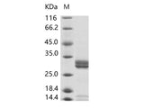 Recombinant Enterovirus D68 (EV-D68) (strain Fermon) VP4 Protein (Fc Tag)