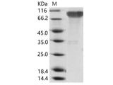 Recombinant Epstein-Barr virus (Herpesvirus 4) EBV Glycoprotein gp350 / EBV GP350 Protein (His Tag)