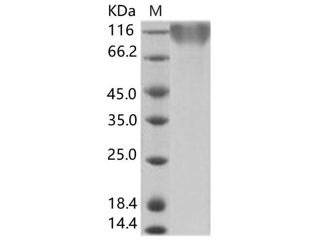 Recombinant Epstein-Barr virus (Herpesvirus 4) EBV Glycoprotein gp350 / EBV GP350 Protein (His Tag)
