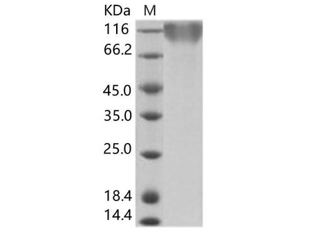 Recombinant Epstein-Barr virus (Herpesvirus 4) EBV Glycoprotein gp350 / EBV GP350 Protein (His Tag)