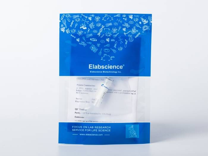 Recombinant Epstein-Barr virus (Herpesvirus 4) EBV Glycoprotein gp350 / EBV GP350 Protein (His Tag)