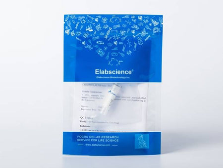 Recombinant Epstein-Barr virus (Herpesvirus 4) EBV Glycoprotein gp350 / EBV GP350 Protein (His Tag)