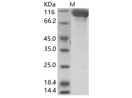 Recombinant Hendra virus (HeV) (isolate Horse/Autralia/Hendra/1994) Glycoprotein Protein (Fc Tag)