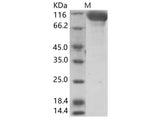 Recombinant Hendra virus (HeV) (isolate Horse/Autralia/Hendra/1994) Glycoprotein Protein (Fc Tag)
