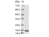 Recombinant Hepatitis B Virus (HBV)(ayw/France/Tiollais/1979) Capsid protein (His Tag)