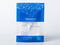 Recombinant HIV-1 (group M, subtype A, isolate 92RW020) Envelope glycoprotein gp160 Protein (gp120 subunit) (His Tag)