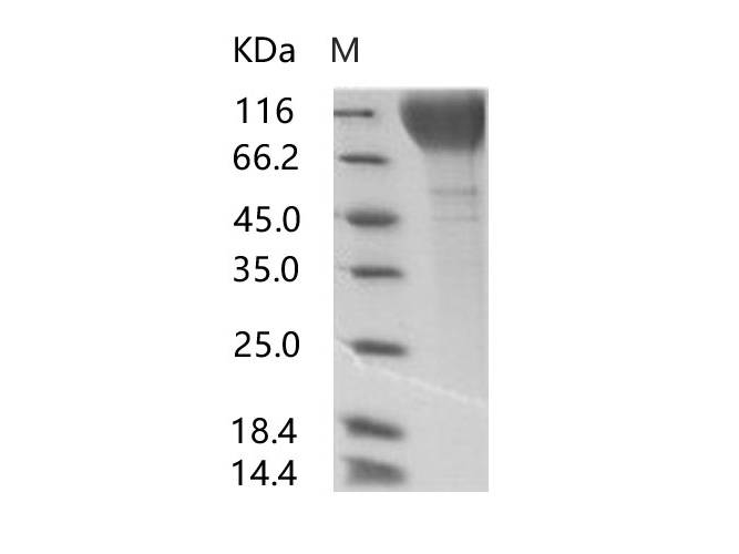 Recombinant HIV-1 gp120 Protein (group P, strain RBF168) (His Tag)