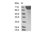 Recombinant HIV-1 gp120 Protein (group P, strain RBF168) (His Tag)