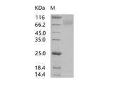 Recombinant HIV-1 gp140 Protein (group P, strain RBF168) (Fc Tag)