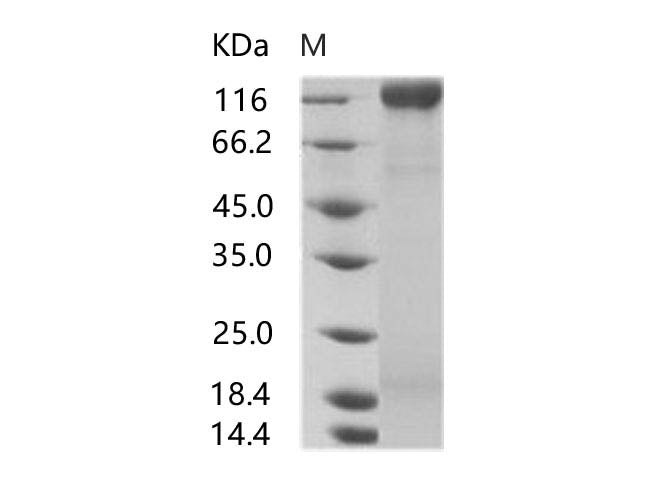 Recombinant HIV-1 gp160 Protein (gp120 subunit) (group N, strain 06CM-U14296) (His Tag)