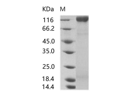 Recombinant HIV-1 gp160 Protein (gp120 subunit) (group N, strain 06CM-U14296) (His Tag)