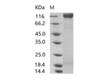 Recombinant HIV-1 gp160 Protein (gp120 subunit) (group N, strain 06CM-U14296) (His Tag)