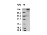 Recombinant Human cytomegalovirus (HCMV) Glycoprotein B / gB Protein