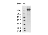 Recombinant Human cytomegalovirus (HCMV) Glycoprotein B / gB Protein (ECD, Fc Tag)