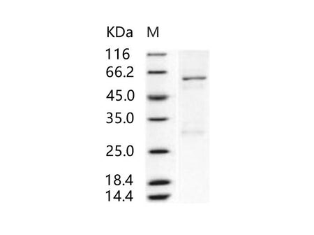 Recombinant Human Enterovirus 71 VP0 Protein (His & GST Tag)