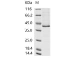 Recombinant Human mastadenovirus E (HAdV-E) fiber Recombinant (His Tag)