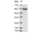 Recombinant Human parainfluenza virus 4b (HPIV-4b) Hemagglutinin-neuraminidase Recombinant (aa 48-579, His Tag)