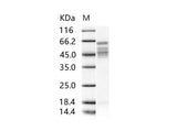 Recombinant RSV Fusion protein / RSV-F (Strain RSS-2) Protein (His Tag)