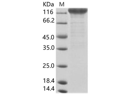 Recombinant CyCMV (strain OT-1) glycoprotein B / GB Protein (Fc Tag)