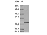 Recombinant Porcine circovirus 2 (PCV2) Capsid protein (His Tag)