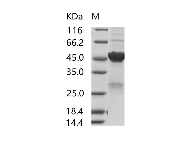 Recombinant SARS-CoV Nucleoprotein / NP Protein (His Tag)