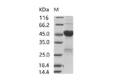 Recombinant SARS-CoV Nucleoprotein / NP Protein (His Tag)