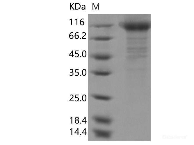 Recombinant SARS-CoV-2 Spike S1(N234Q)(His Tag)