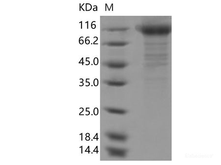 Recombinant SARS-CoV-2 Spike S1(N234Q)(His Tag)