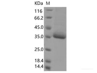 Recombinant SARS-CoV-2 Spike RBD(F377L)(His Tag)
