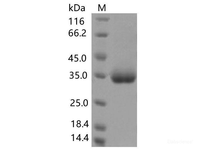 Recombinant SARS-CoV-2 Spike RBD(K378R)(His Tag) - MSE Supplies LLC