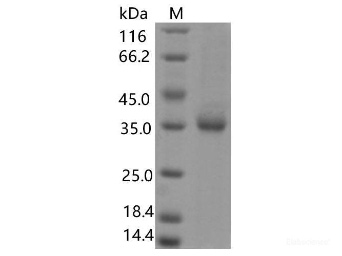 Recombinant SARS-CoV-2 Spike RBD(Q409E)(His Tag) - MSE Supplies LLC