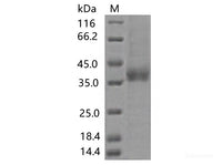 Recombinant SARS-CoV-2 Spike RBD(A372T)(His Tag), Cell Assays, Elabscience Biotechnology, MSE Supplies