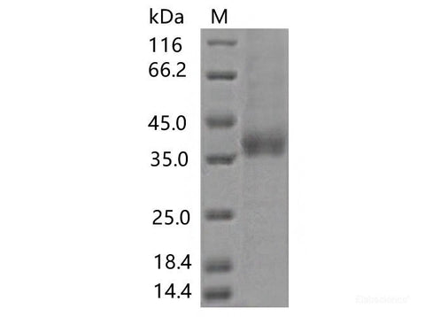 Recombinant SARS-CoV-2 Spike RBD(A372T)(His Tag), Cell Assays, Elabscience Biotechnology, MSE Supplies