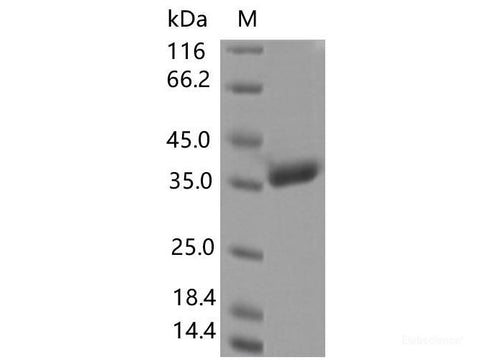 Recombinant SARS-CoV-2 Spike RBD(A344S)(His Tag), Cell Assays, Elabscience Biotechnology, MSE Supplies