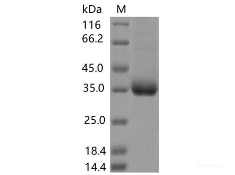 Recombinant SARS-CoV-2 Spike RBD(A520V)(His Tag), Cell Assays, Elabscience Biotechnology, MSE Supplies