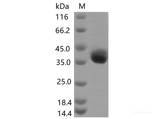 Recombinant SARS-CoV-2 Spike RBD(E406Q)(His Tag), Cell Assays, Elabscience Biotechnology, MSE Supplies