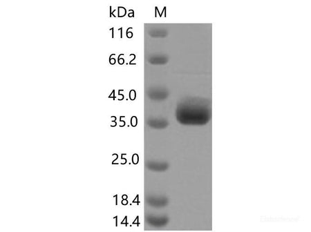 Recombinant SARS-CoV-2 Spike RBD(F490S)(His Tag), Cell Assays, Elabscience Biotechnology, MSE Supplies
