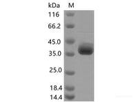Recombinant SARS-CoV-2 Spike RBD(F490S)(His Tag), Cell Assays, Elabscience Biotechnology, MSE Supplies