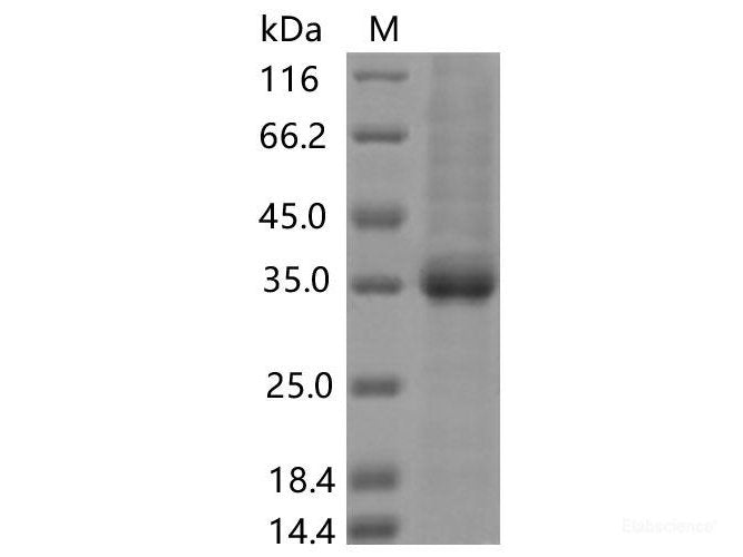 Recombinant SARS-CoV-2 Spike RBD(N370S)(His Tag), Cell Assays, Elabscience Biotechnology, MSE Supplies